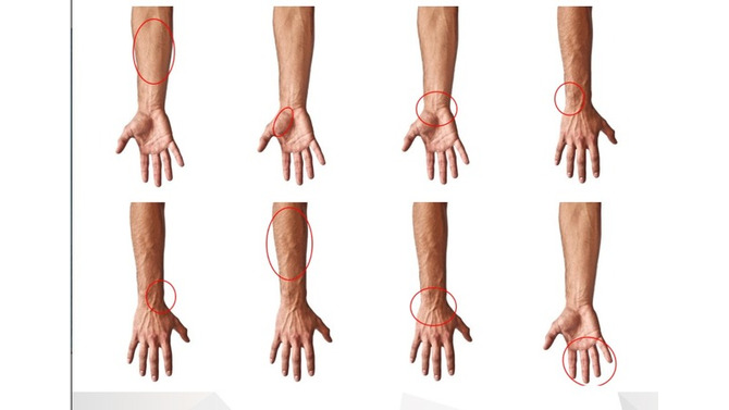 ゲームに必要な筋肉をピンポイントにストレッチ！ゲーマーの手/手首の痛みに特化したヘルスガイドサイト公開